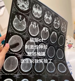 铁子们，下次大笑时注意点！  第2张
